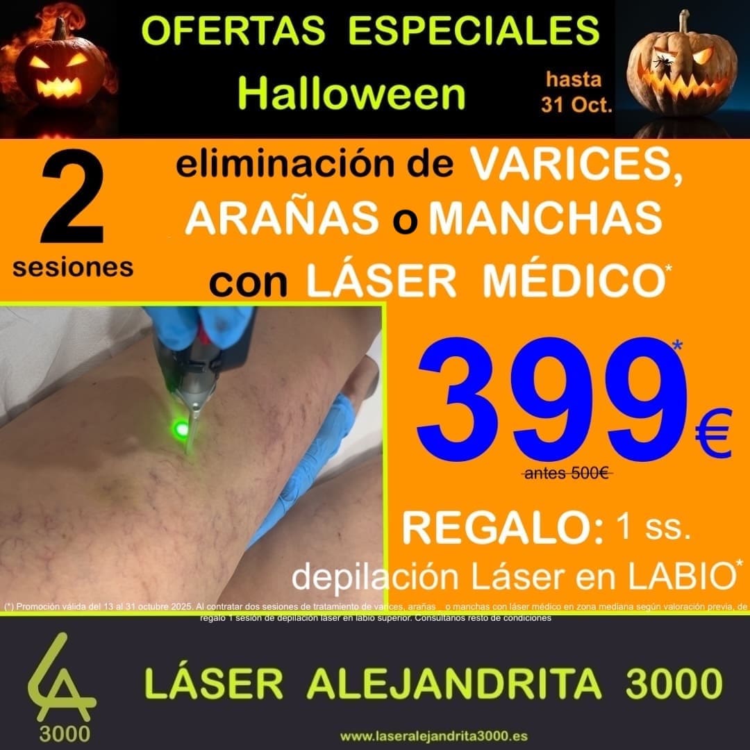VASCULAR_2 ss VARICES_399€ + Regalo Láser_OCT 25