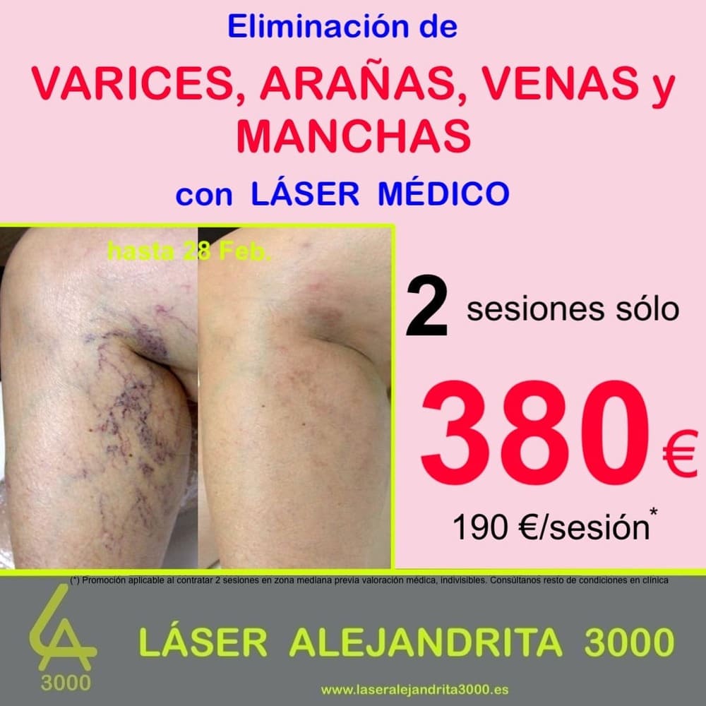 Ofertas Febrero 2026